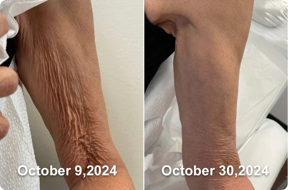 Zvoevo® VitaBotox Firming Elixir combines Botox 45 c78f1e1798887217201233253f902f40