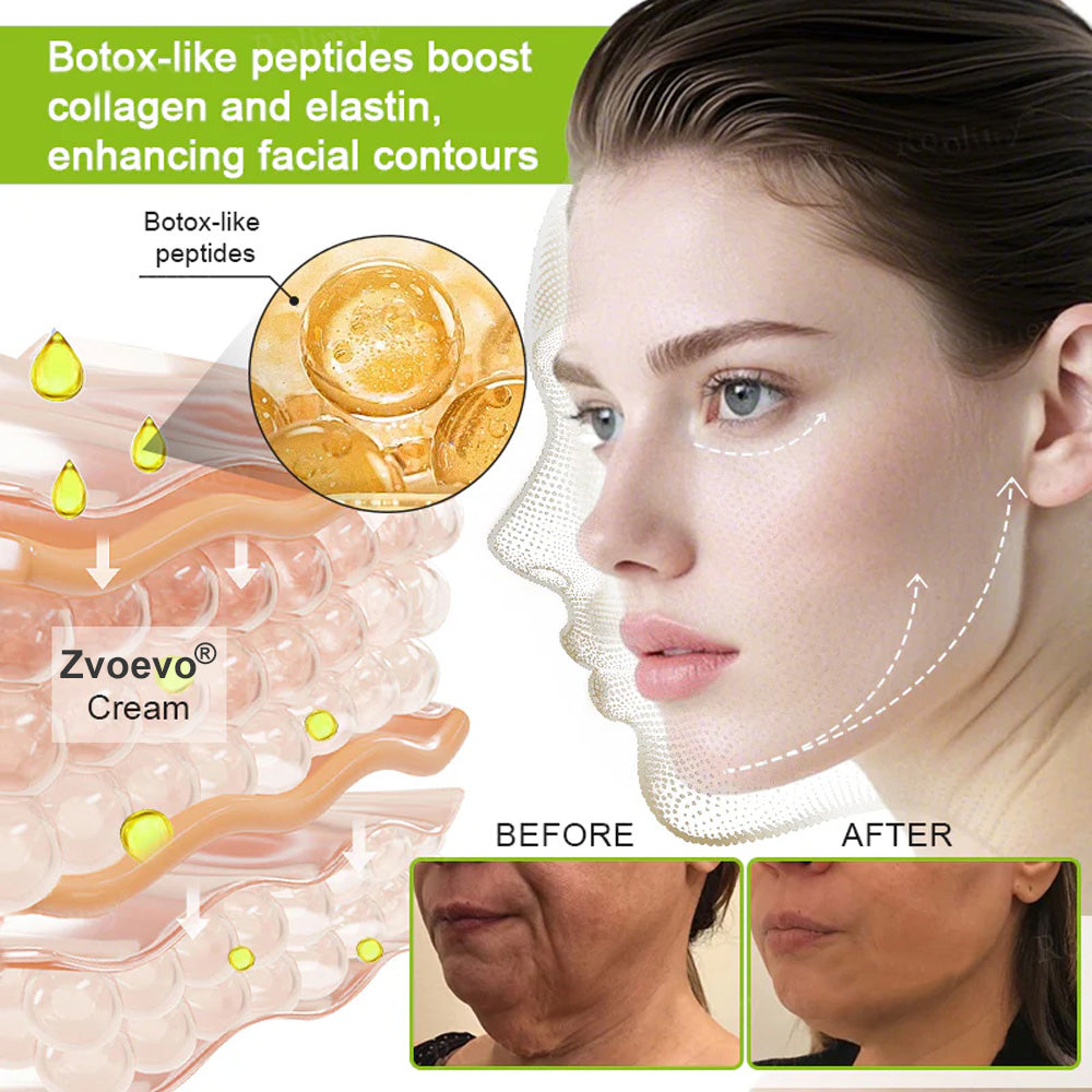 Zvoevo® VitaBotox Firming Elixir combines Botox 39 cd9407531a5956f3fdcdbca42dd524a3