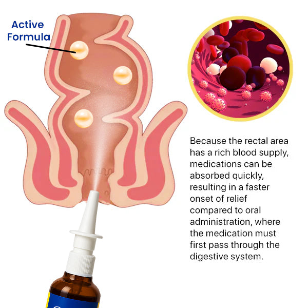Cvreoz® Herbal Hemorrhoid Treatment Anal Spray