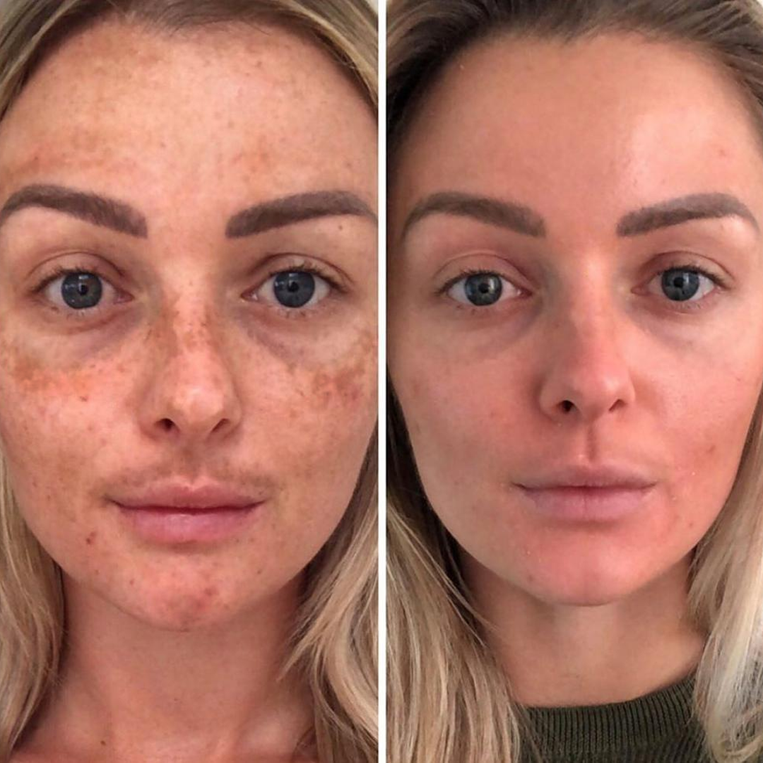 d41c223956c0dee6966cc6d611302dd8