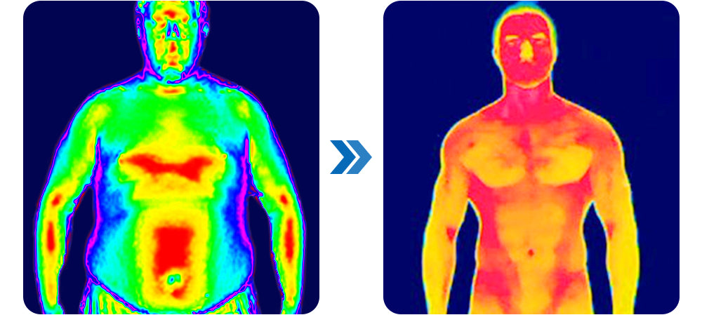🧑‍⚕️NESLEMY™ Ultrasonic Fat Blasting and Detoxing Wristband B