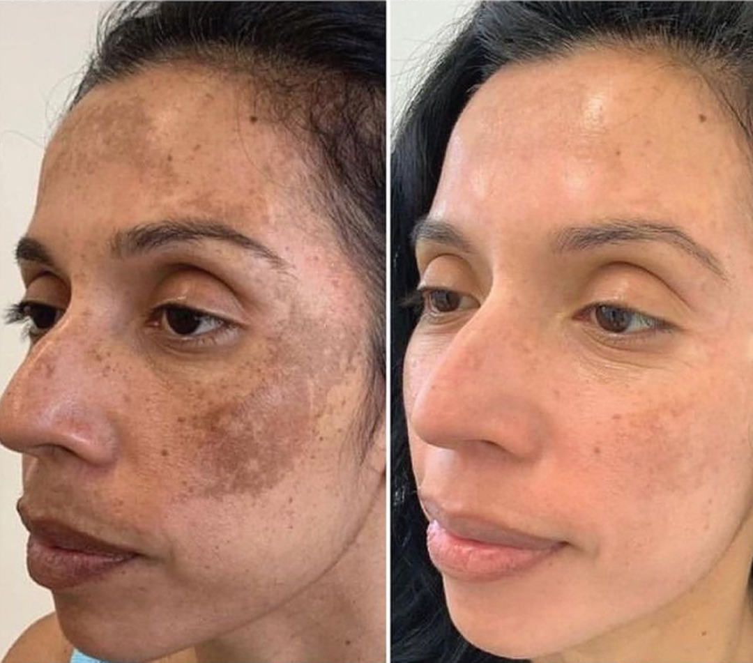 d63017ac1bf68f35fa394e3e52de945c