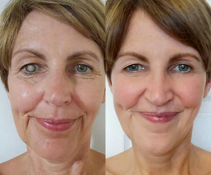 LAOZIK™ OptiFusion Nano Eye Drops Serum —Nano Technology Restores Clear Vision, No Glasses, No Surgery