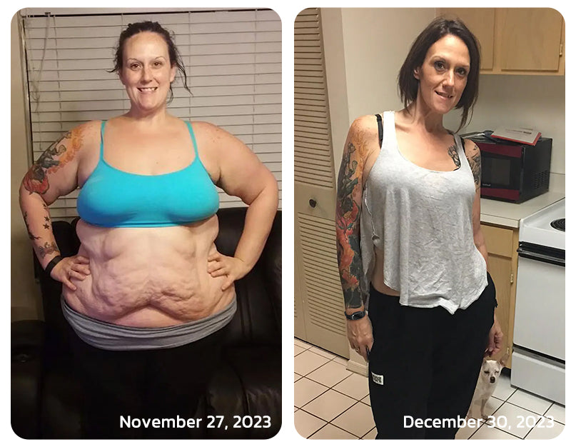 🧑‍⚕️NESLEMY™ Ultrasonic Fat Blasting and Detoxing Wristband B