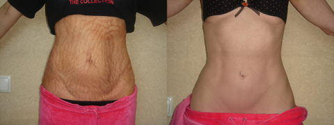 BBOJI™ 7-Day Multi-Effect All-in-One Skincare Cream image BBOJI™ 7-Day Multi-Effect All-in-One Skincare Cream