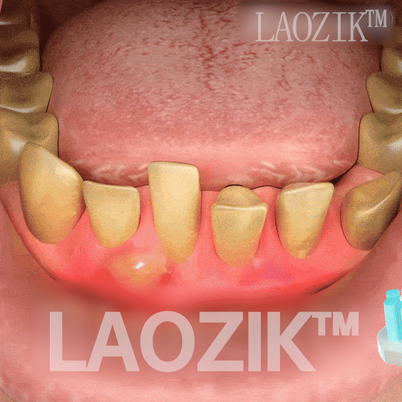 LAOZIK™ Bee Poison Advanced Gum Healing Toothpaste 28 ddf34e44f42dab025480c26685887114