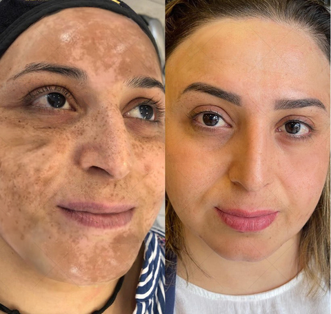 BBOJI™ 7-Day Multi-Effect All-in-One Skincare Cream image BBOJI™ 7-Day Multi-Effect All-in-One Skincare Cream