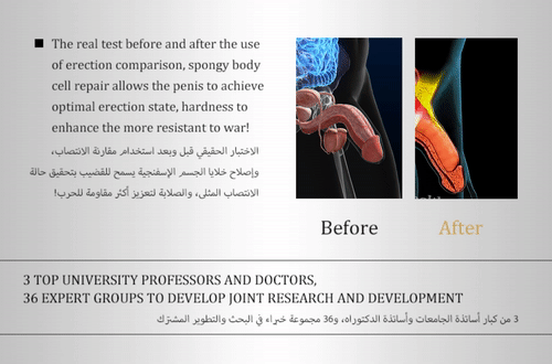 Interactive Demo