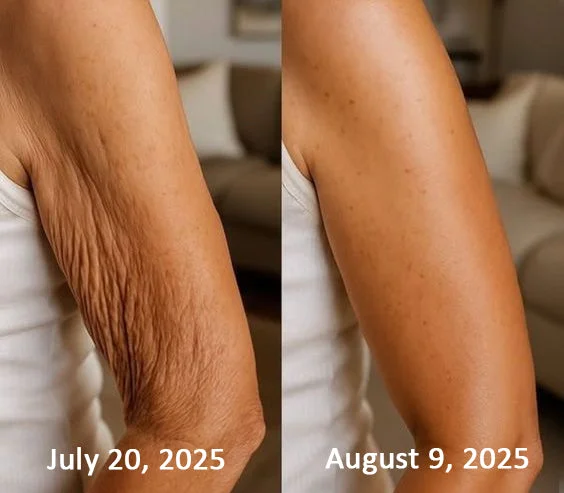 Rolimey® Botox & Vita-A Retinol Firming & Anti-Wrinkle Serum