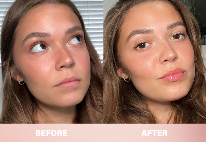 LIMETOW® Lip Plumper Kit image LIMETOW® Lip Plumper Kit