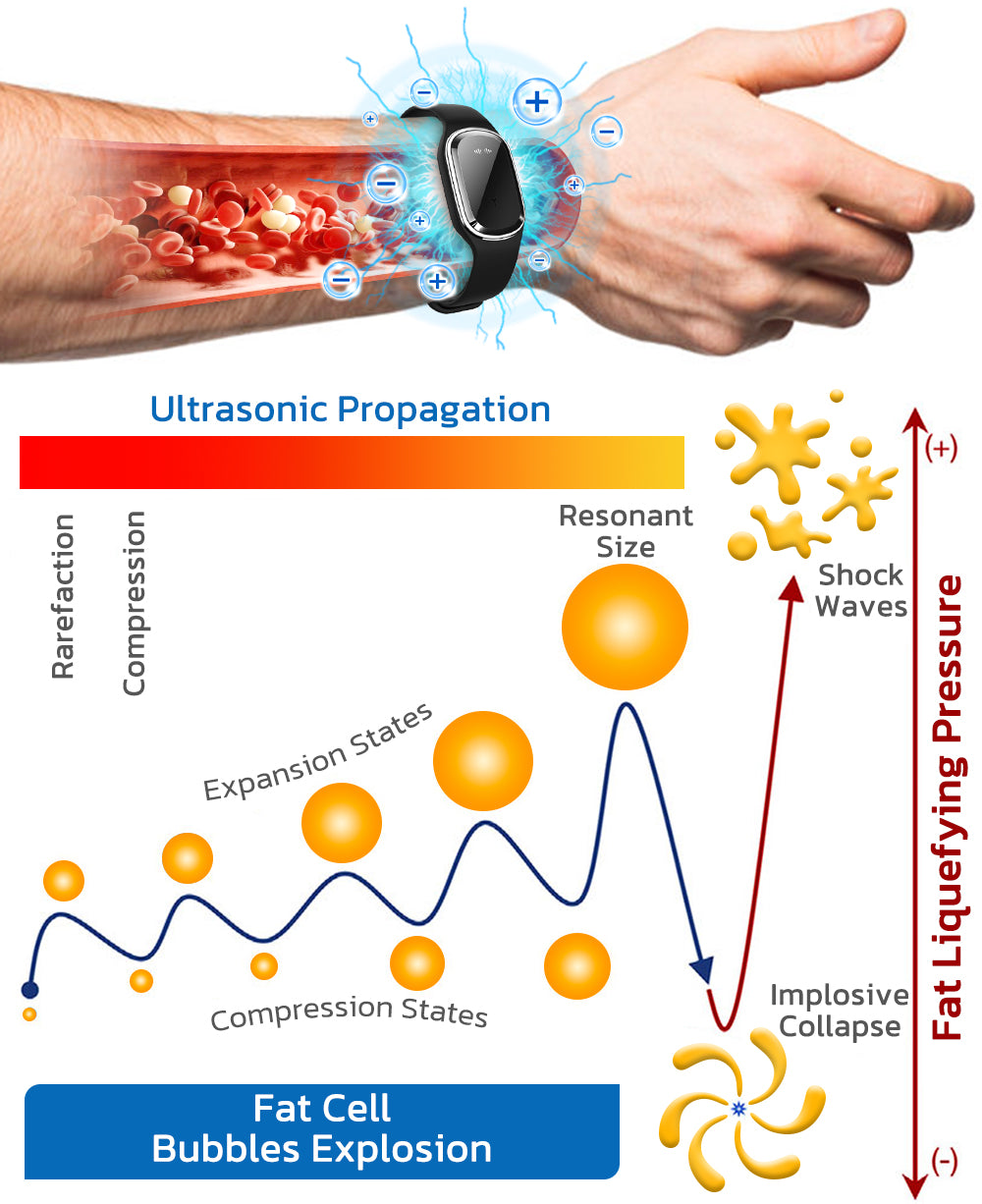 🧑‍⚕️NESLEMY™ Ultrasonic Fat Blasting and Detoxing Wristband B
