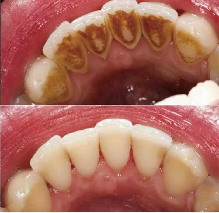 Rosopl® Multi-Action Oral Care Essence image Rosopl® Multi-Action Oral Care Essence