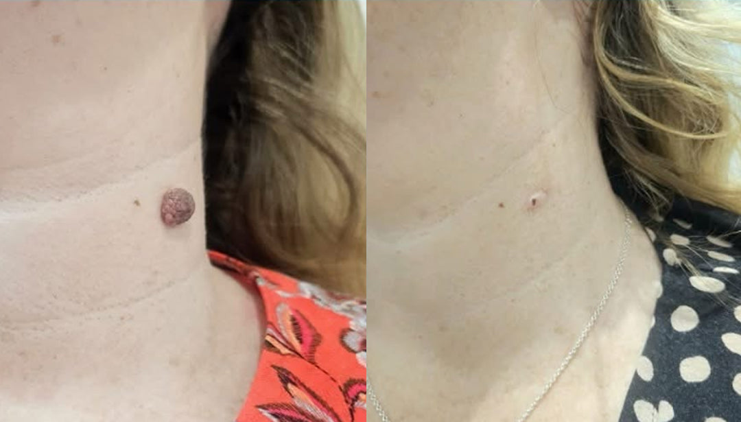 BQYOOM Dual-Action Renewal Cream