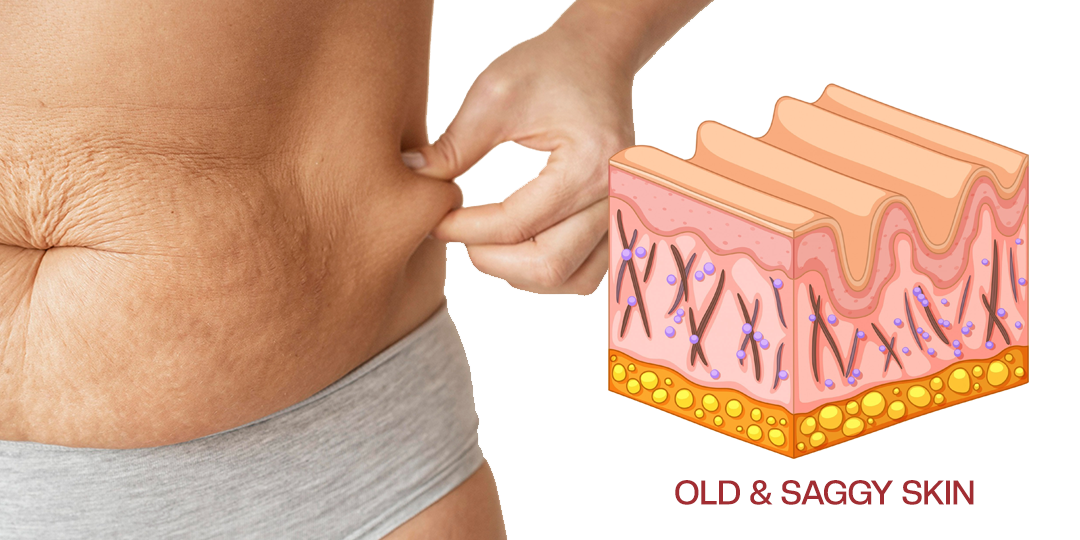 NATRAVOR® AuréLuxe Body Firming Oil image NATRAVOR® AuréLuxe Body Firming Oil