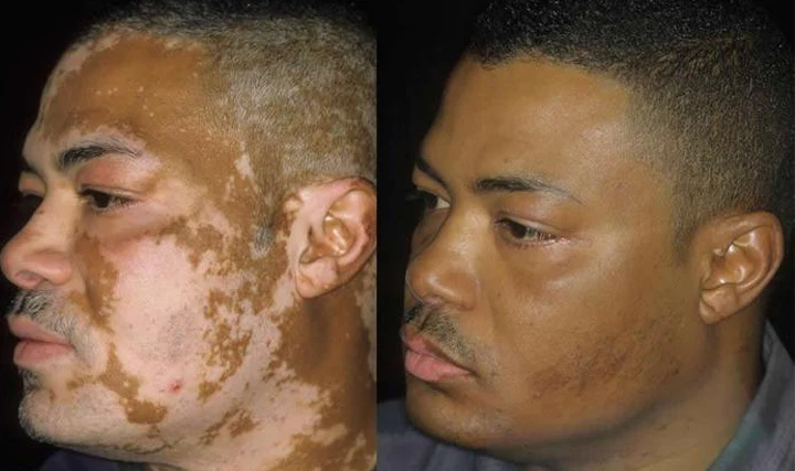 YUNPSO® VitiHeali Yellowjacket Neurotoxic fluid Extractm Cream Ultra 45 YUNPSO® VitiHeali Yellowjacket Neurotoxic fluid Extractm Cream Ultra