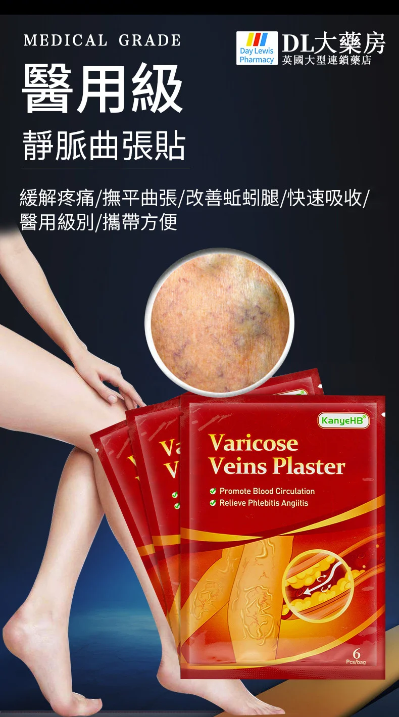 靜脈曲張貼片