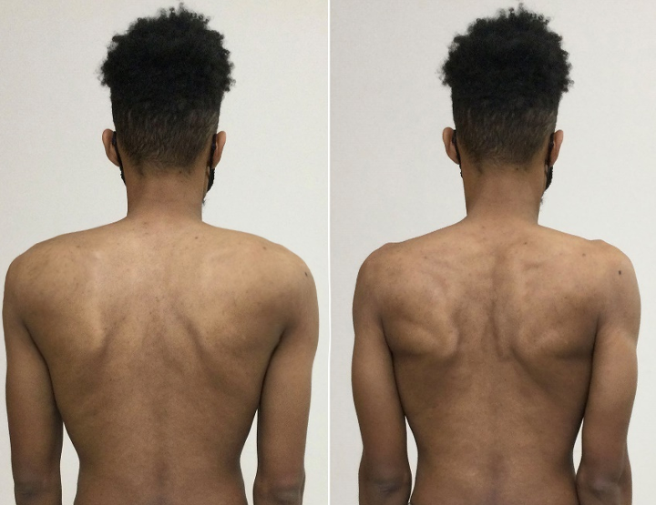 Caselast® Premium Curcumin Pain Relief Gel 26 Caselast® Premium Curcumin Pain Relief Gel